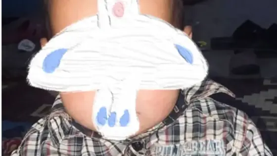 فاجعة جديدة تحل بسكان اكرض امليلن اقليم الصويرة: وفاة طفل طفل بسبب لسعة عقرب