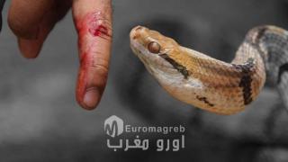 الحسيمة.. نقل شخص إلى المستشفى الإقليمي بعد تعرضه للدغة أفعى سامة ببني بونصار
